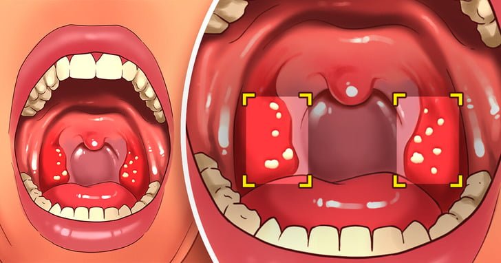 6 Effective Ways To Avoid Bad Breath Even After Sleeping