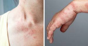 Body Alerts For Possible Health Issues