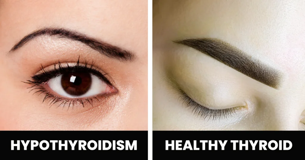 10 Symptoms That May Reveal Health Problems