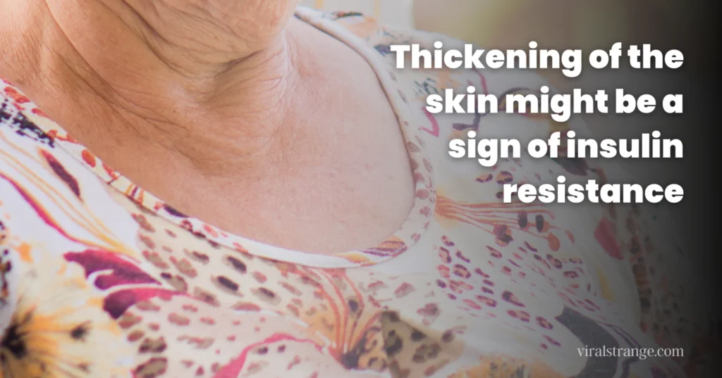 10 Symptoms That May Reveal Health Problems
