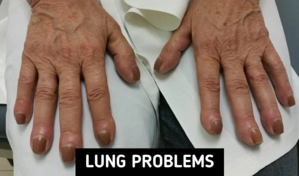 8 Body Symptoms You Should Be Aware Of