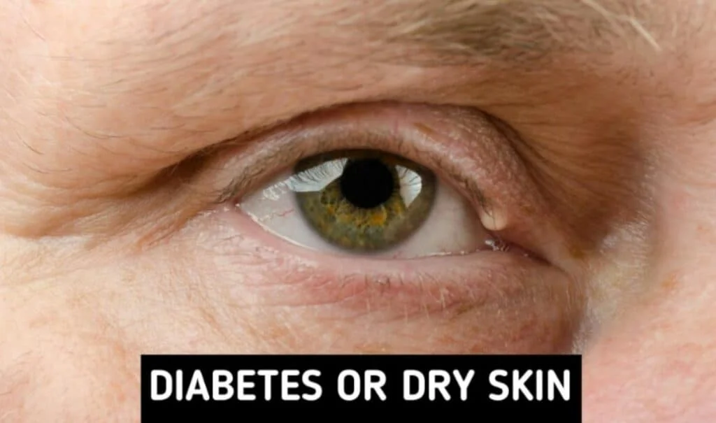8 Body Symptoms You Should Be Aware Of