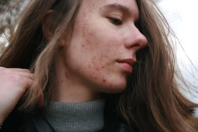 Serious Diseases Diagnosed Through Skin Signals