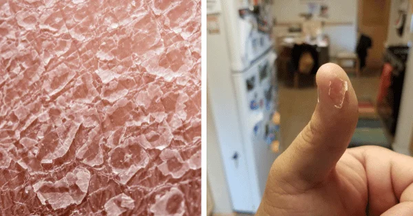 Serious Diseases Diagnosed Through Skin Signals
