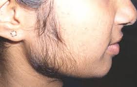 IF YOU’RE A WOMAN WITH CHIN WHISKERS, PAY ATTENTION. HERE’S WHAT IT MEANS!