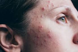 IF YOU’RE A WOMAN WITH CHIN WHISKERS, PAY ATTENTION. HERE’S WHAT IT MEANS!