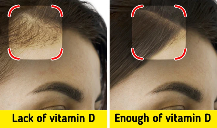 7 Critical Signs That Point to Vitamin D Deficiency