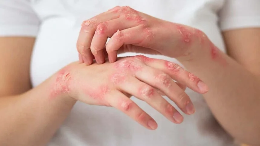 Skin Conditions: Top 10 Most Common 1 Usa People Skin Conditions: Top 10 Most Common