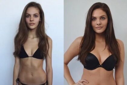 Before-And-After/ Models Promote Self-Love By Sharing Their Bodies’ Journey