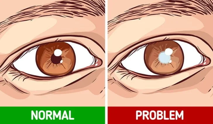 10 Subtle Signals Our Body Sends When Something Is Wrong