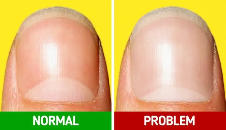 10 Subtle Signals Our Body Sends When Something Is Wrong