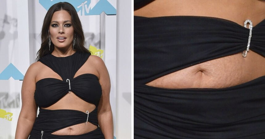 10 Female Stars Who Don’t Hide Their Imperfections and Challenge Modern Beauty Standards