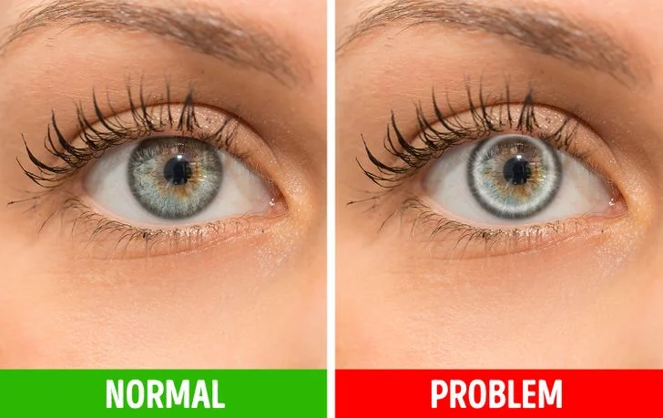 10 Signs Your Body Can Be Signaling a Real Trouble