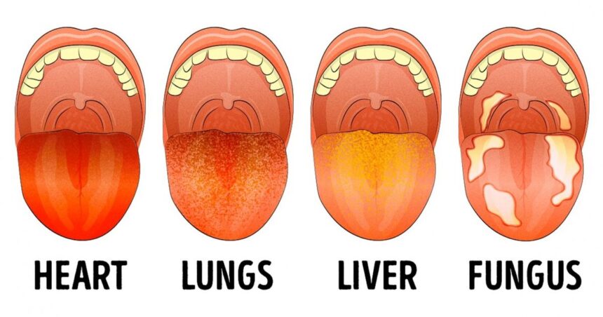 9 Things Your Tongue Is Trying to Tell You About Your Health