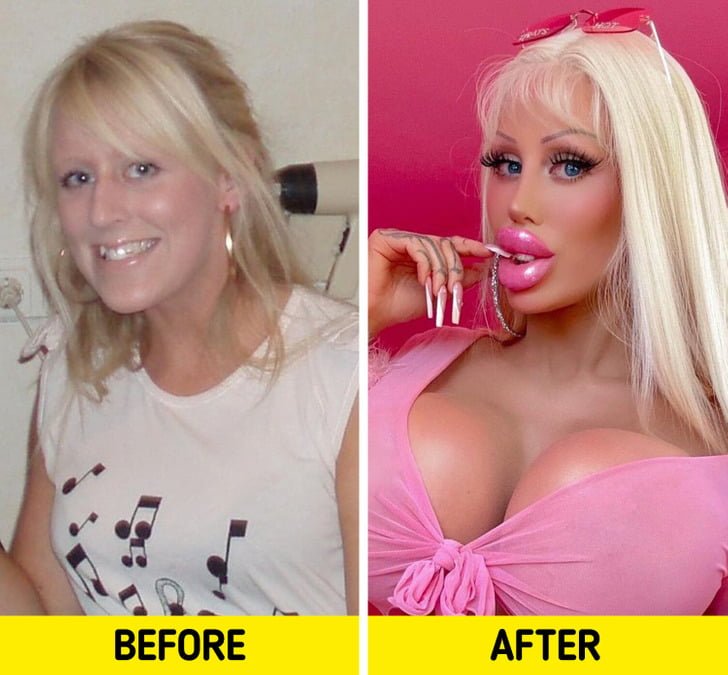 A Woman Spends a Fortune to Become a Real-Life Barbie Doll, “I’ve Always Been Attracted to the Extreme”