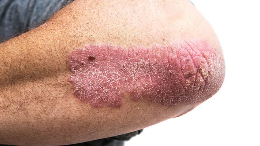 Red Spots on Skin: 13 Common Causes