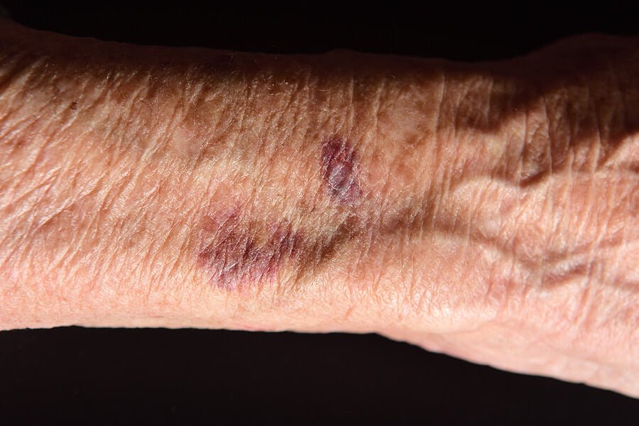 10 Early Signs of Health Problems You Shouldn't Ignore