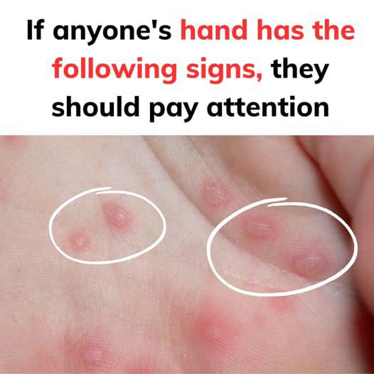 If Anyone’s Hand Has the Following Signs, They Should Pay Attention