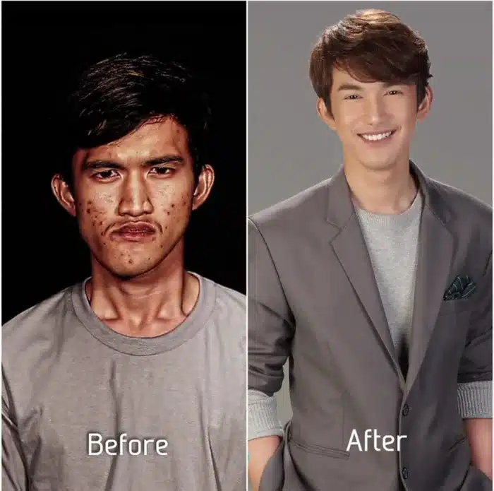 His Mother Couldn’t Identify Him After Plastic Surgery…
