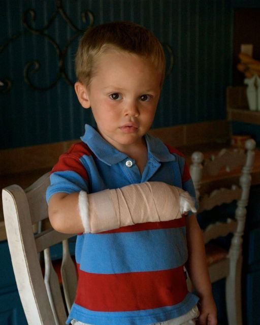 Mon garçon a eu son premier os cassé — et une leçon que j'aurais aimé apprendre plus tôt 1 USA People Mon garçon a eu sa première fracture osseuse — et une leçon que j'aurais aimé apprendre plus tôt