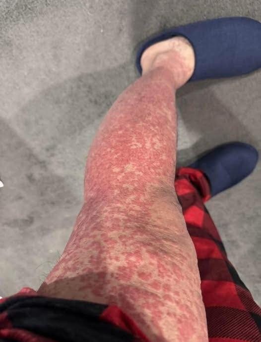 These are the consequences of sleeping with…See more